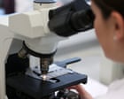 New AI test can predict which men will benefit from prostate cancer drug
