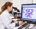 UK-wide drug trial hailed as a ‘milestone’ in leukaemia treatment