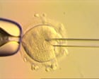 Eight healthy babies born after IVF using DNA from three people