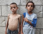 ‘We faced hunger before, but never like this’: skeletal children fill hospital wards as starvation grips Gaza