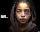 AI-generated ‘poverty porn’ fake images being used by aid agencies