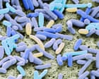 Sharp global rise in antibiotic-resistant infections in hospitals, WHO finds