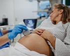 Pregnant women in England at ‘growing risk’ of serious injury in childbirth