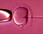 Human eggs ‘rejuvenated’ in advance that could boost IVF success rates