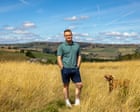 Experience: a brain surgeon dropped part of my skull on the floor